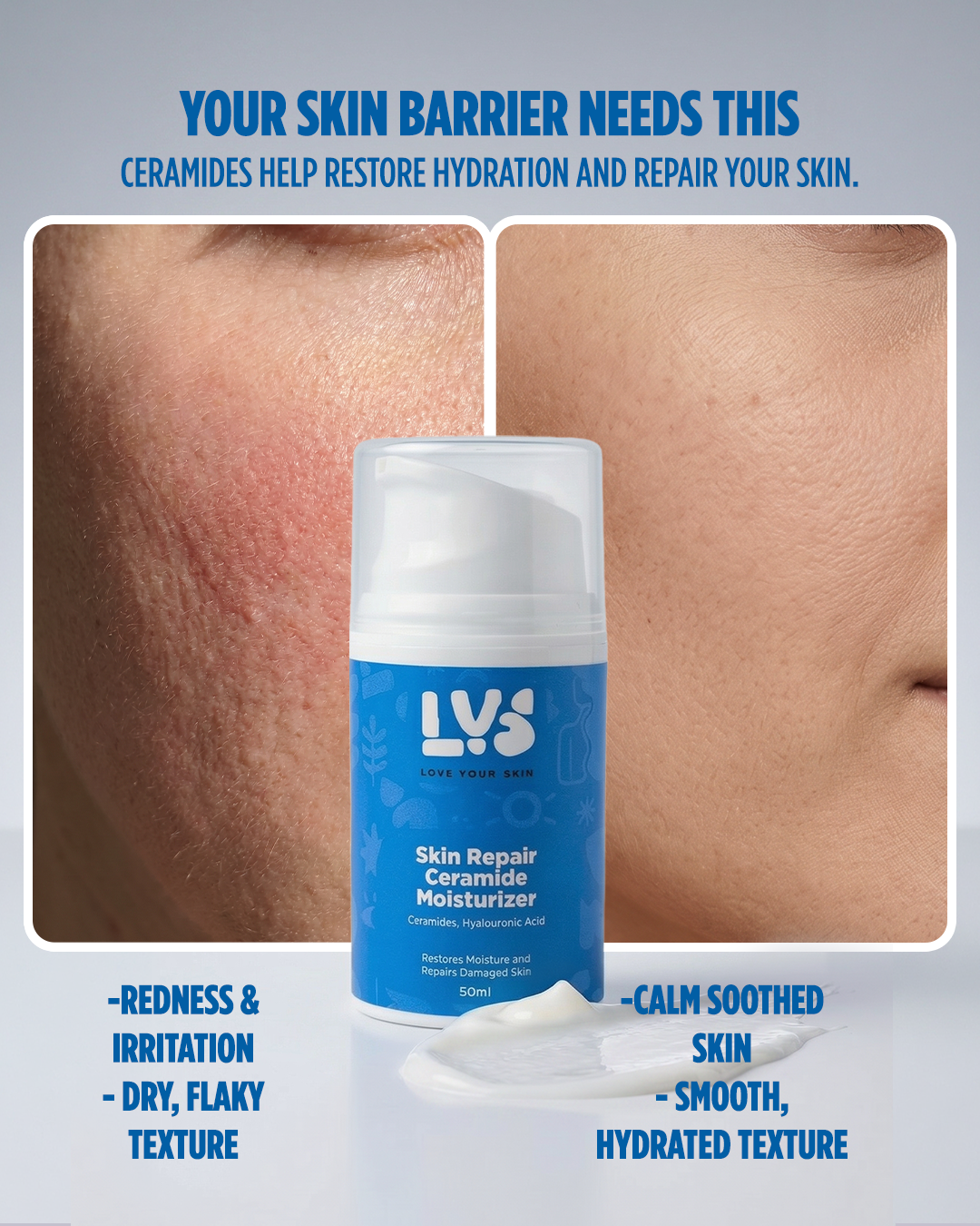 Skin Repair Ceramide Moisturizer
